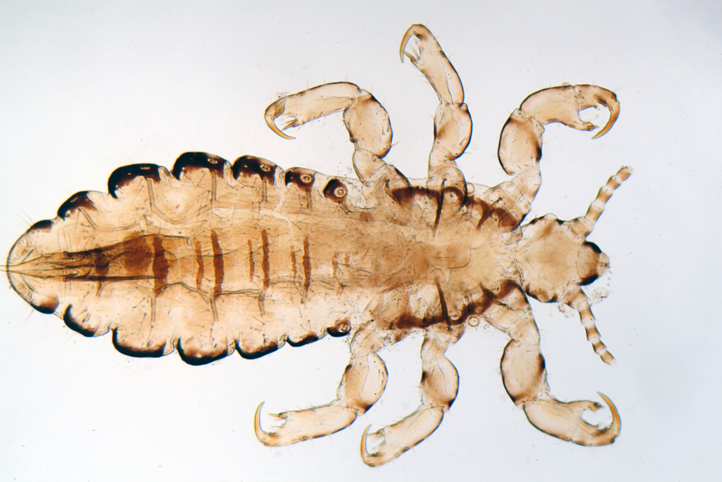 Lice-Facts-Page-Image-1030x687